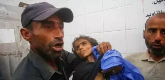 Gazze'de Açlıktan Ölen Çocuklar için Tepki
