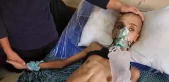 Gazze'de İnsani Durum Çığır Açıyor: 16 Yaşındaki Muhenned'in Dramatik Hikayesi