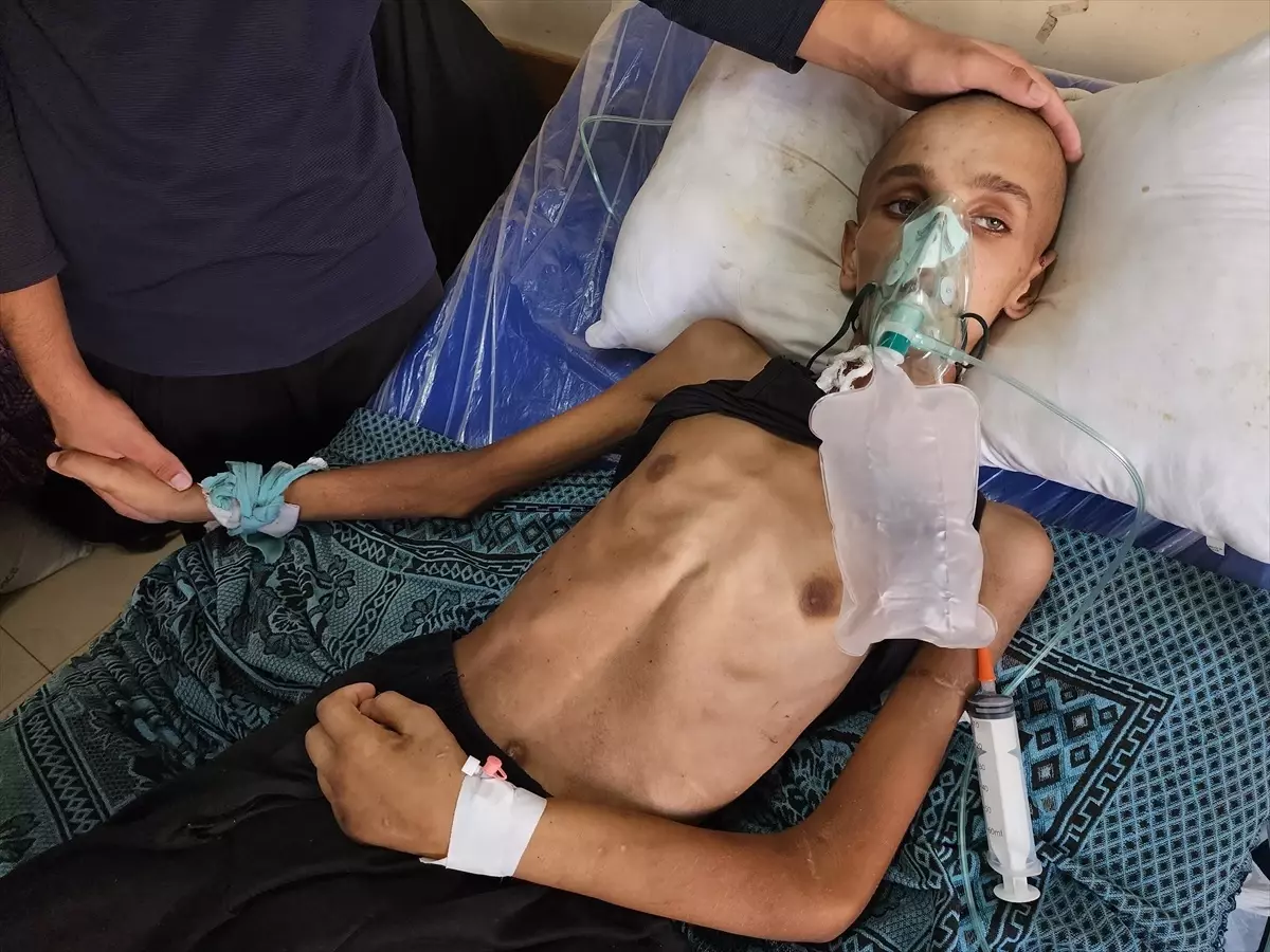 Gazze'de İnsani Durum Çığır Açıyor: 16 Yaşındaki Muhenned'in Dramatik Hikayesi