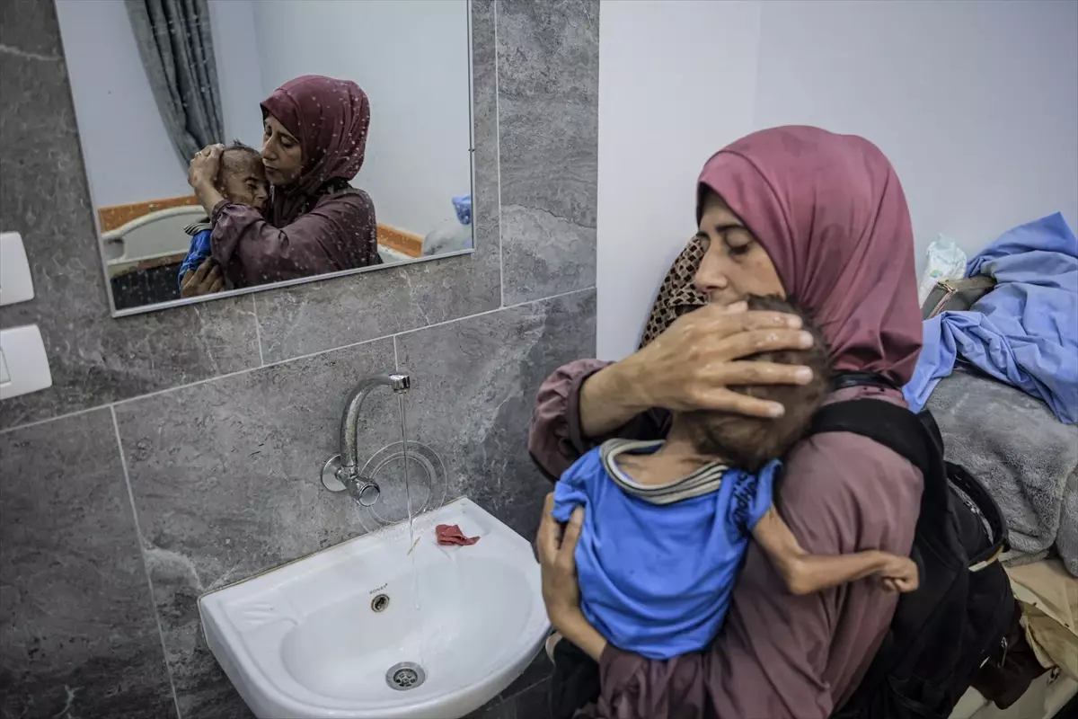 Gazze Şeridi'nde 'açlığın' sembolü haline gelen Filistinli bebeğin doktoru İsrail'in iddialarını yalanladı