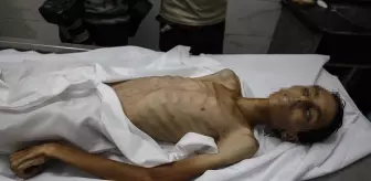 Gazze'de Açlık Politikası: 17 Yaşındaki Filistinli Çocuk Hayatını Kaybetti