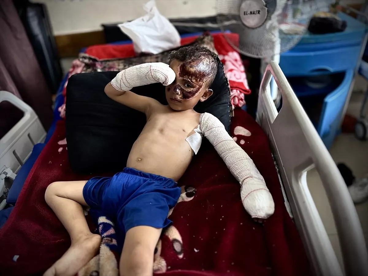 Gazze'de Saldırılarda Yetim Kalan 4 Yaşındaki Ahmed'in Acı Hikayesi
