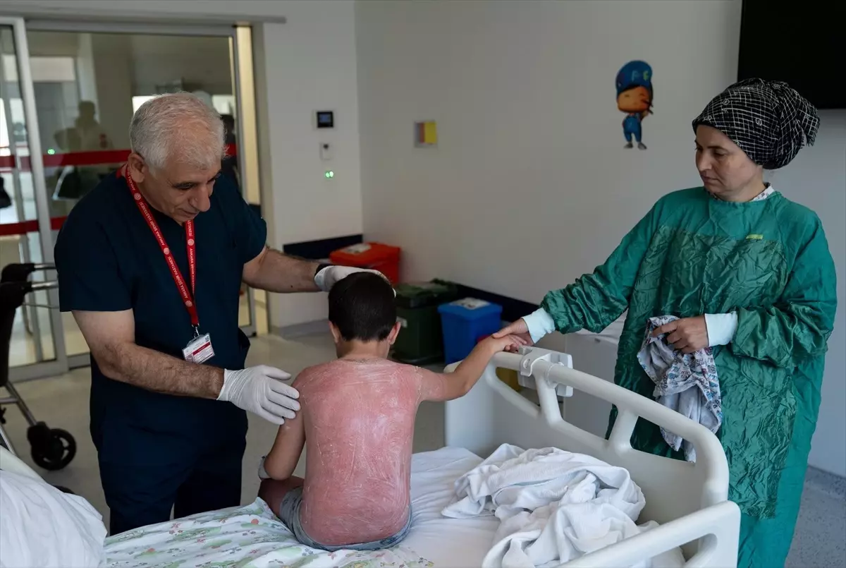 Güneş Yanığına Dikkat: 7 Yaşındaki Çocuk Hastaneye Sevk Edildi