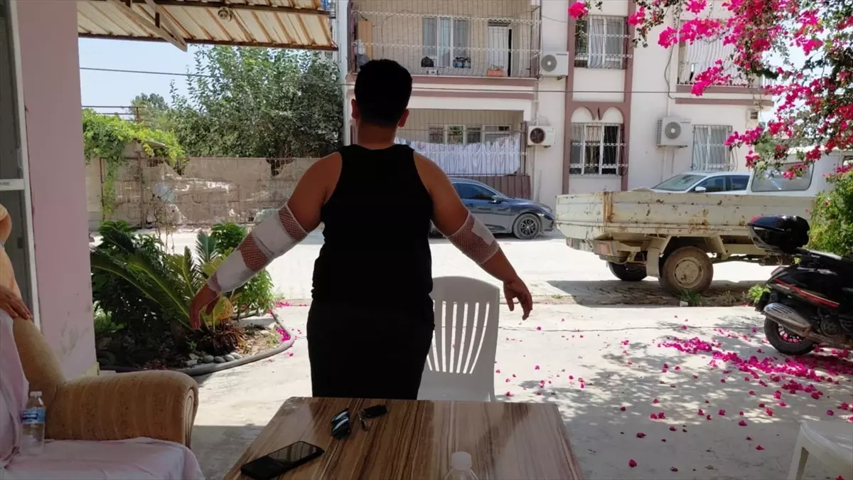 Samandağ'da Sahipsiz Köpek Saldırısı: 10 Yaşındaki Çocuk Yaralandı