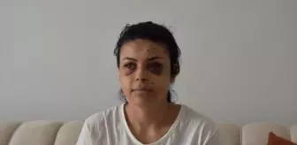 Düğün Kavgasında Kadına Tüfekten Saçma Isabet Etti