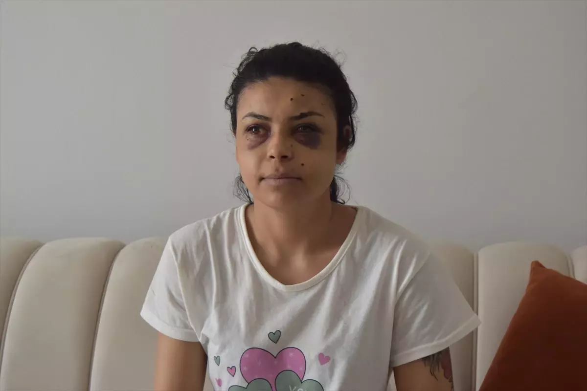 Düğün Kavgasında Kadına Tüfekten Saçma Isabet Etti