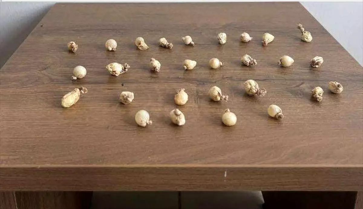 Kocaeli'de Şüpheli Kişinin Midesinden 78 Gram Uyuşturucu Çıktı
