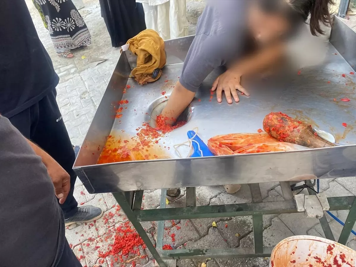 Şanlıurfa'da Salça Makinesine Kapanan Genç Kız Kurtarıldı