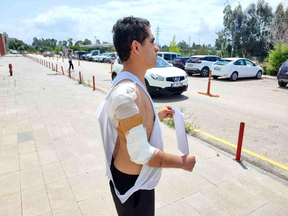 Adana'da Askere Kurt Köpeği Saldırdı