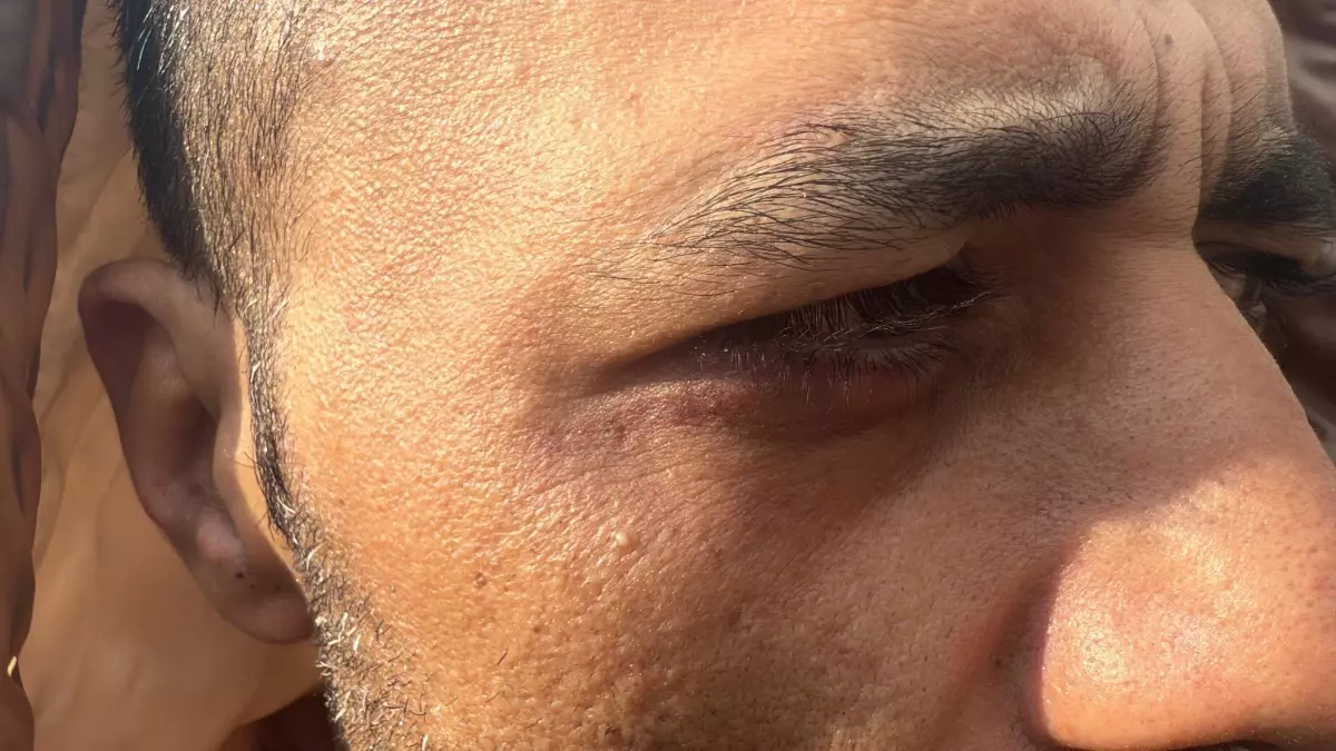 Taksim'de 'Borcunu sileceğiz' yalanıyla alıkonulup darbedildi: 'Şikayetini çek aileni öldürürüz' tehdidi