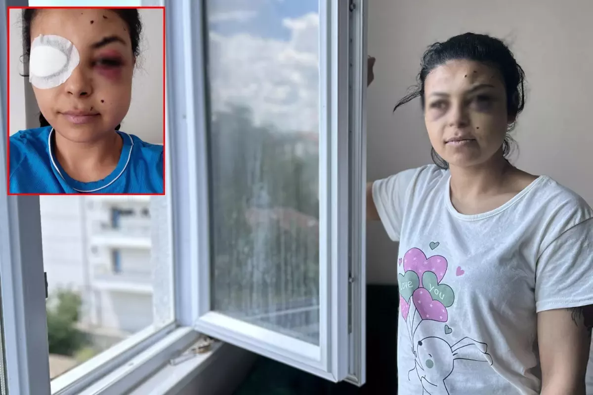 Pencereden düğünü seyrederken gözünden vuruldu: Hayatım bitti