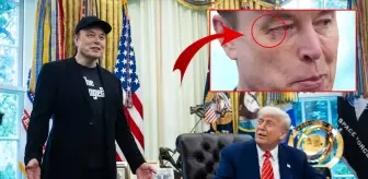 Elon Musk'ın gözüne ne oldu? Basın toplantısının önüne geçen fotoğraf