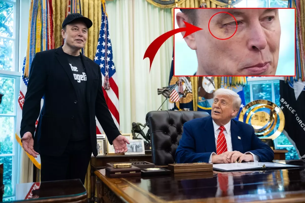 Elon Musk'ın gözüne ne oldu? Basın toplantısının önüne geçen fotoğraf
