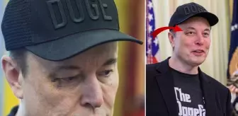 Elon Musk'ın gözündeki morlukla ilgili bomba iddia