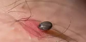 Kene ısırığı sonucu Kırım Kongo Kanamalı Ateşi'ne yakalanan adam hayatını kaybetti