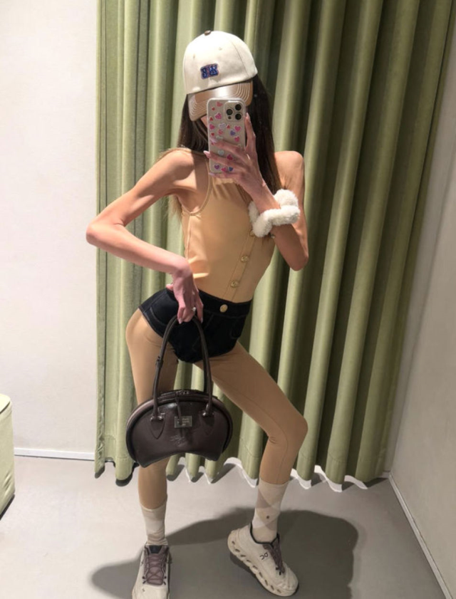 Nihal Candan, diagnosed with Anorexia Nervosa, was hospitalized