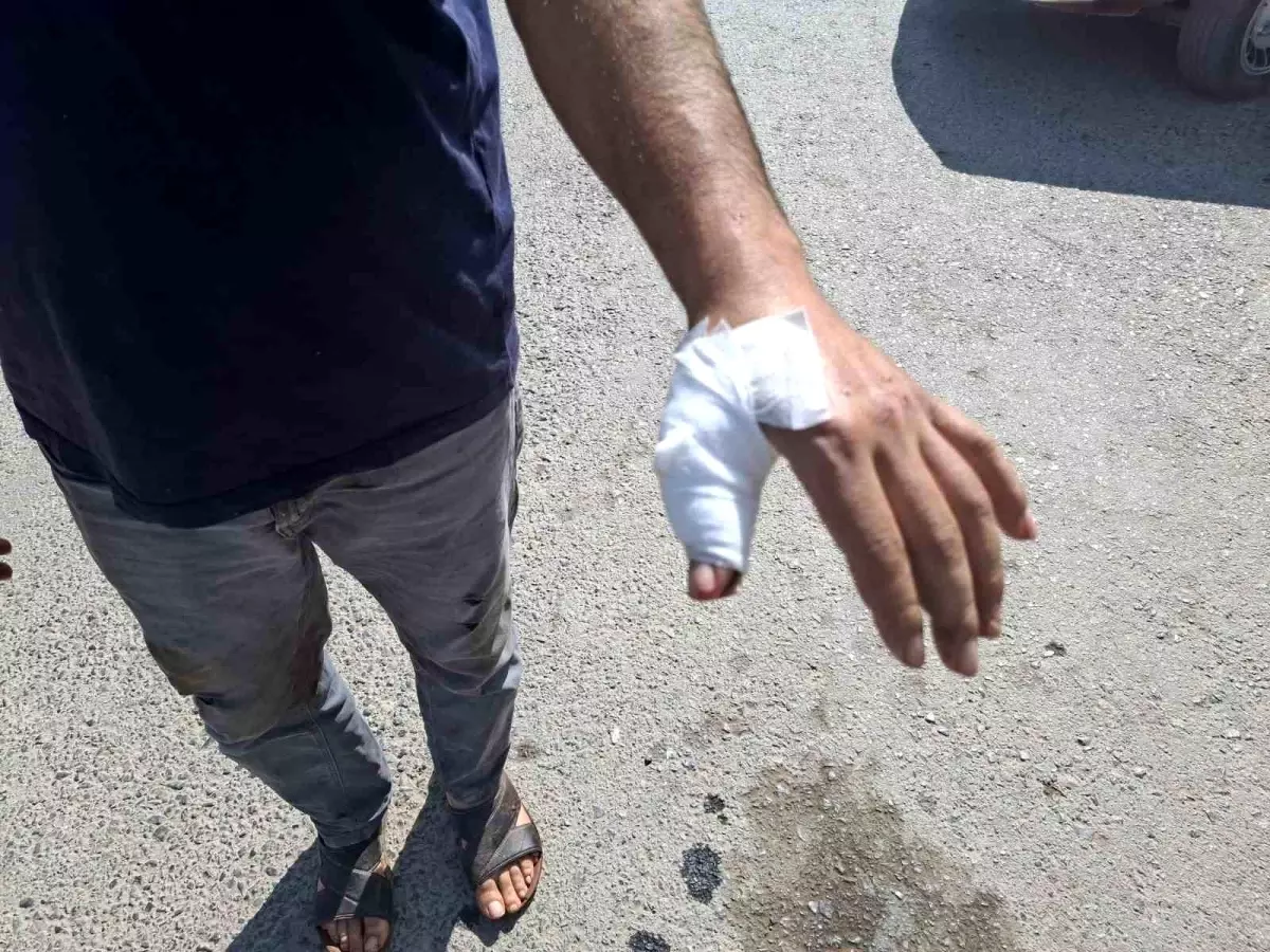 Kahramanmaraş'ta Kurban Bayramı'nda Acemi Kasaplar Hastaneye Akın Etti