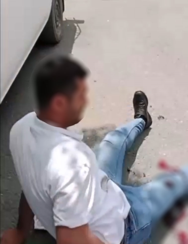 The woman who shot the man bothering her in the legs shared those moments on social media