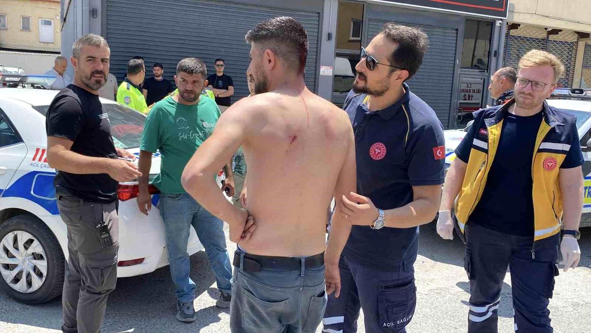 Aksaray'da Keser ve Sopalı Kavga: 1 Yaralı