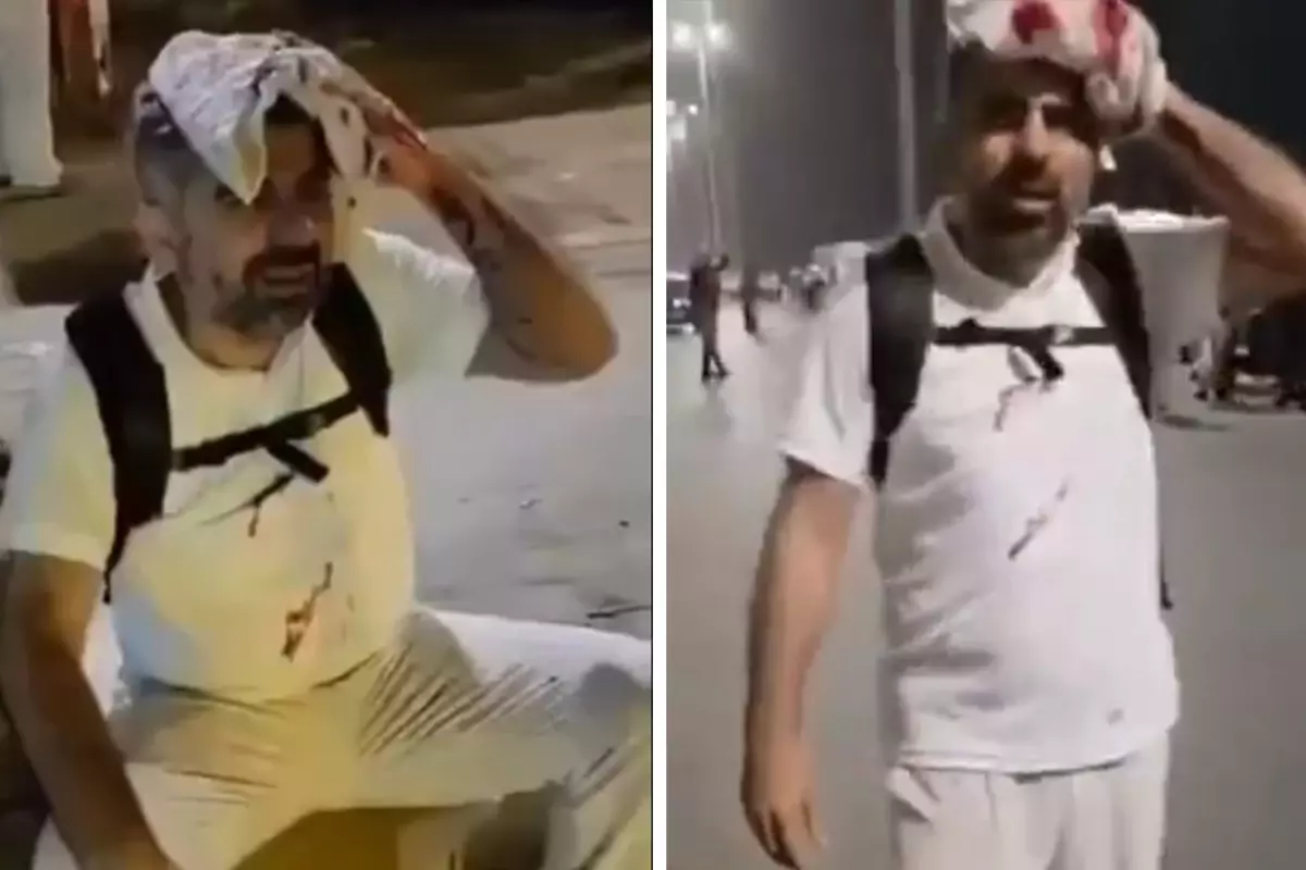 Gazze için yürüyenlere Mısır'da müdahale! HÜDA Par Milletvekili başından yaralandı