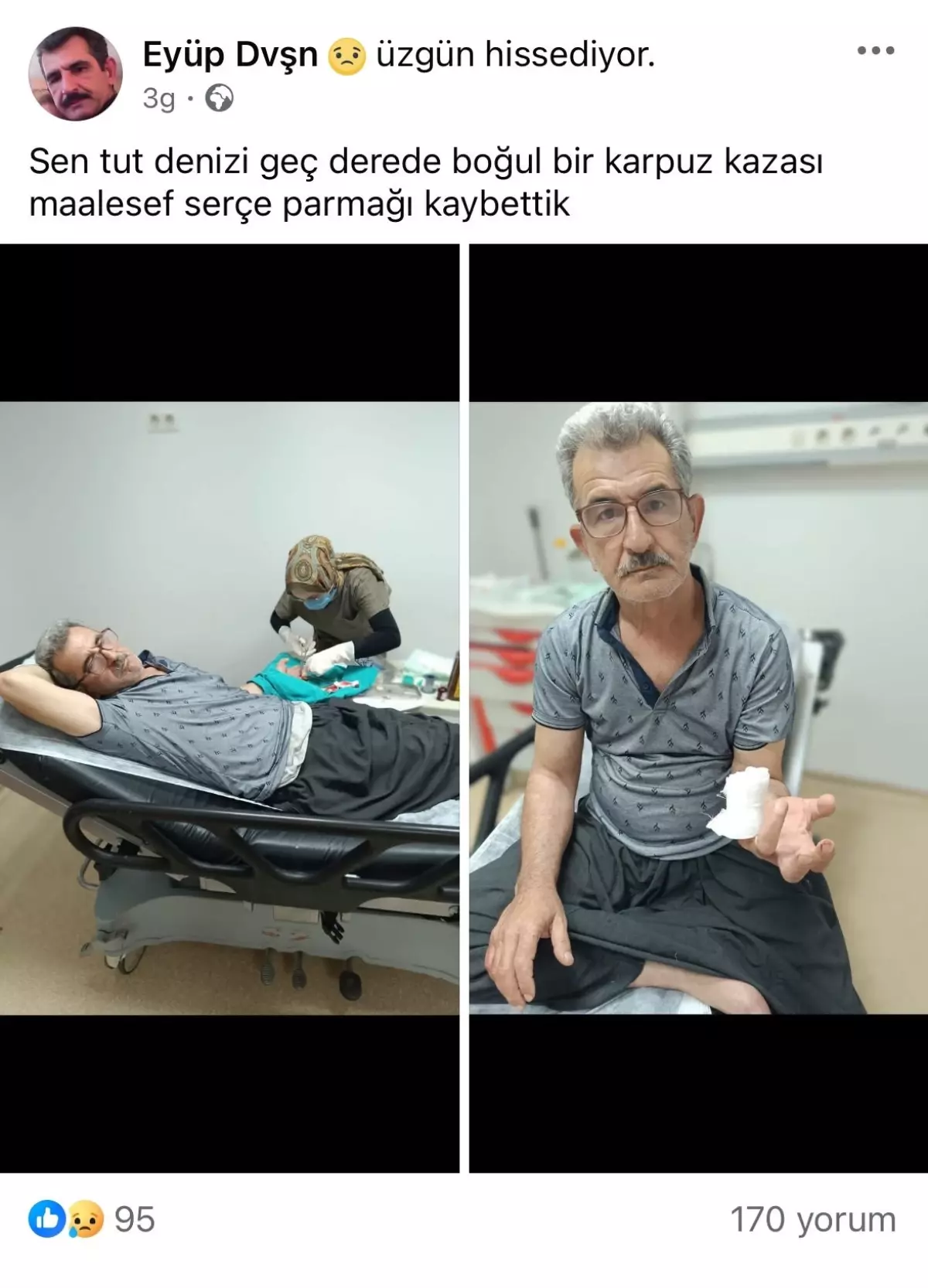 Karpuz Keserken Serçe Parmağını Kesen Kebapçı Hastaneye Kaldırıldı
