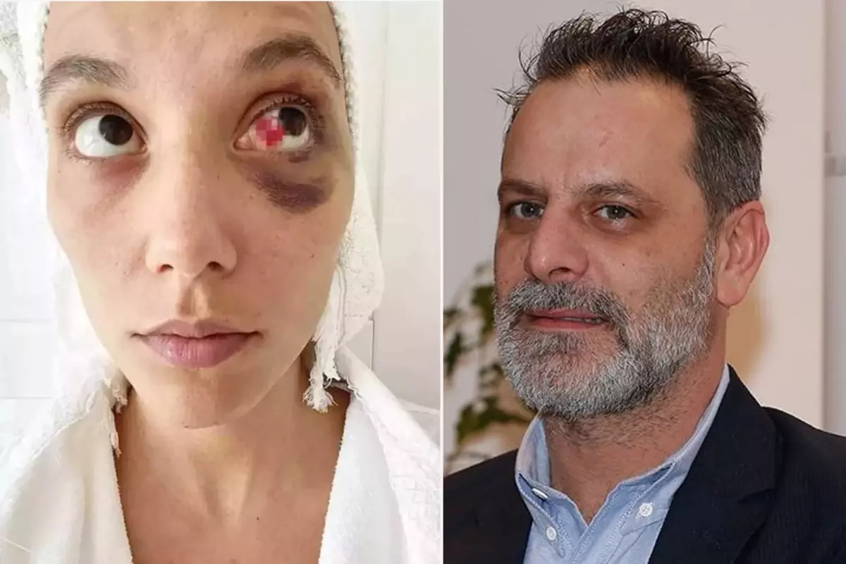Ozan Güven'e 'kasten yaralama' suçundan hapis cezası