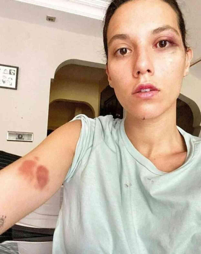 Тюремный срок для Озана Гювена за 'умышленное причинение вреда'