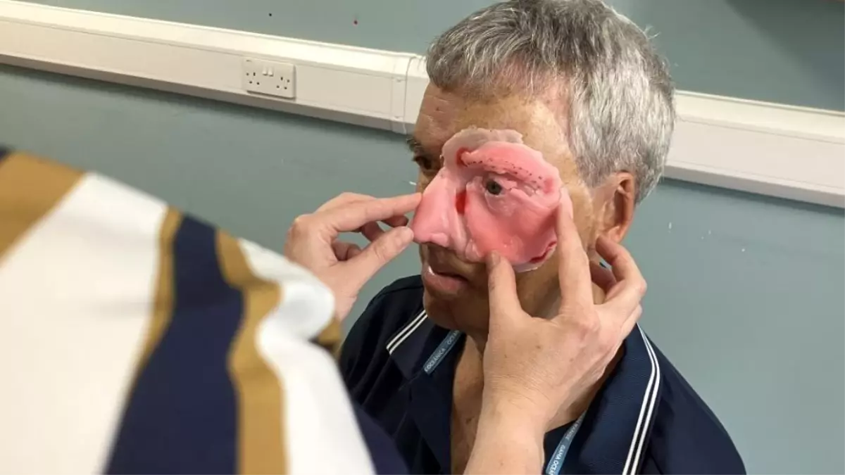 Alkollü Sürücünün Çarptığı Bisikletçi, 3D Tıp Merkezi'nde İlk Hastalar Arasında