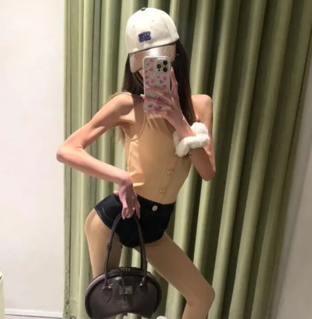 Nihal Candan kimdir, kaç yaşında, ne iş yapıyor? Nihal Candan'ın hastalığı nedir? Nihal Candan kimdir, kaç yaşında, ne iş yapıyor? Nihal Candan'ın hastalığı nedir?