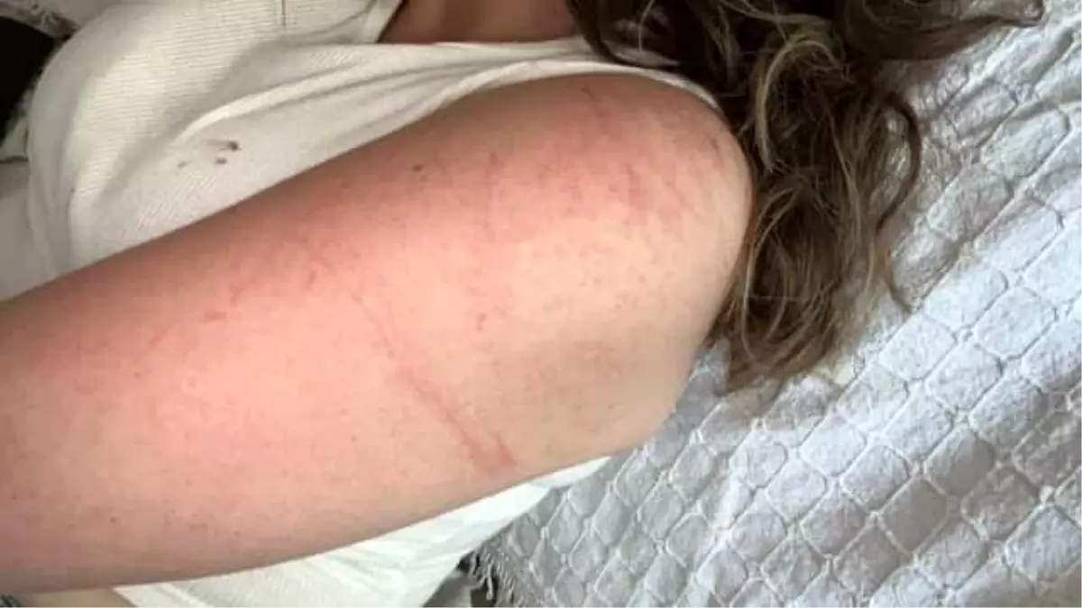 Bursa'da Bıçak Zoruyla Gasp Edebilmek İçin Genç Kızı Takip Eden Saldırgan Yakalandı