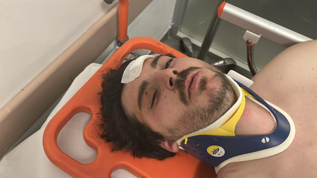 Famous actor Mehmet Akif Akdeniz was brutally beaten in traffic