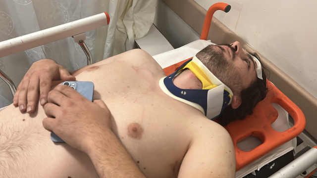 Famous actor Mehmet Akif Akdeniz was brutally beaten in traffic