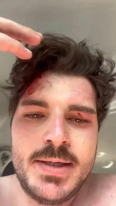 Famous actor assaulted by 4 people: If the truck driver hadn't intervened, I would have died