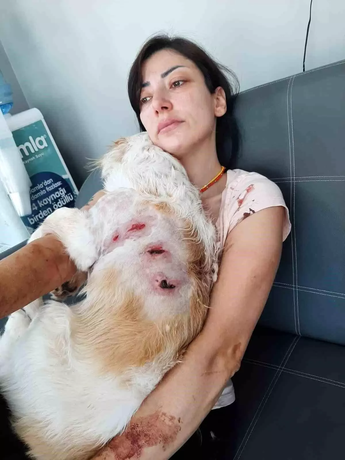Bursa'da Kangal Köpeklerinin Saldırısına Uğrayan Kadın Yaralandı