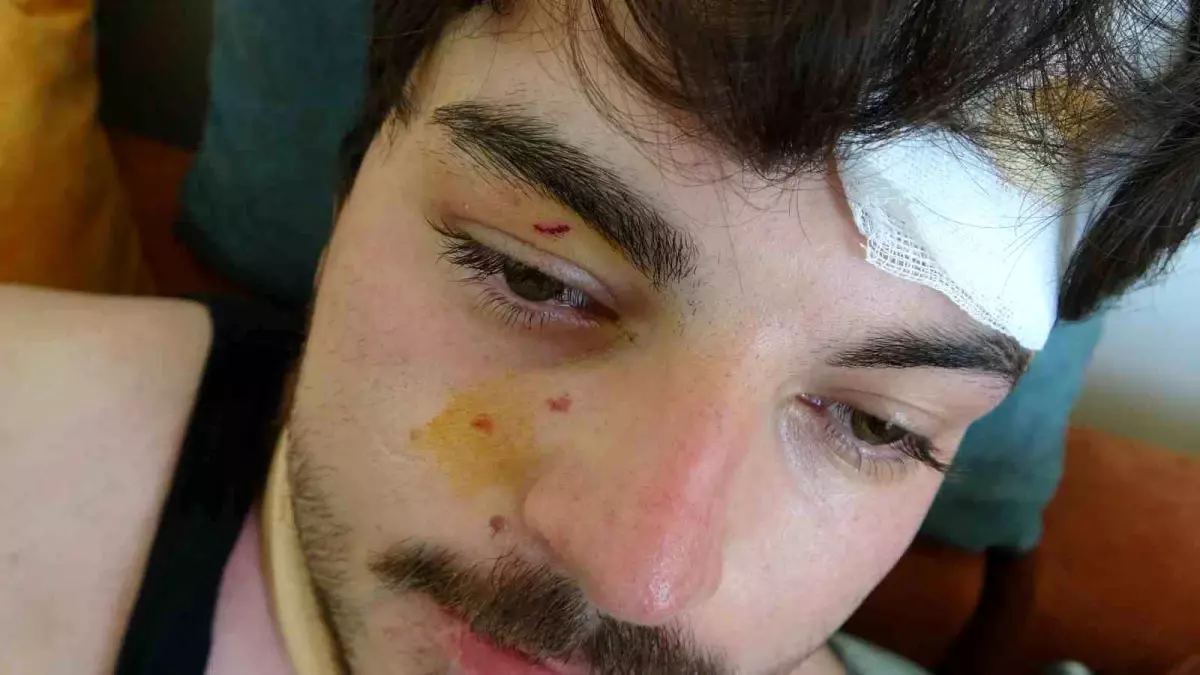 Bahar Dizisi Oyuncusu Mehmet Akif Akdeniz Trafikte Darbedildi