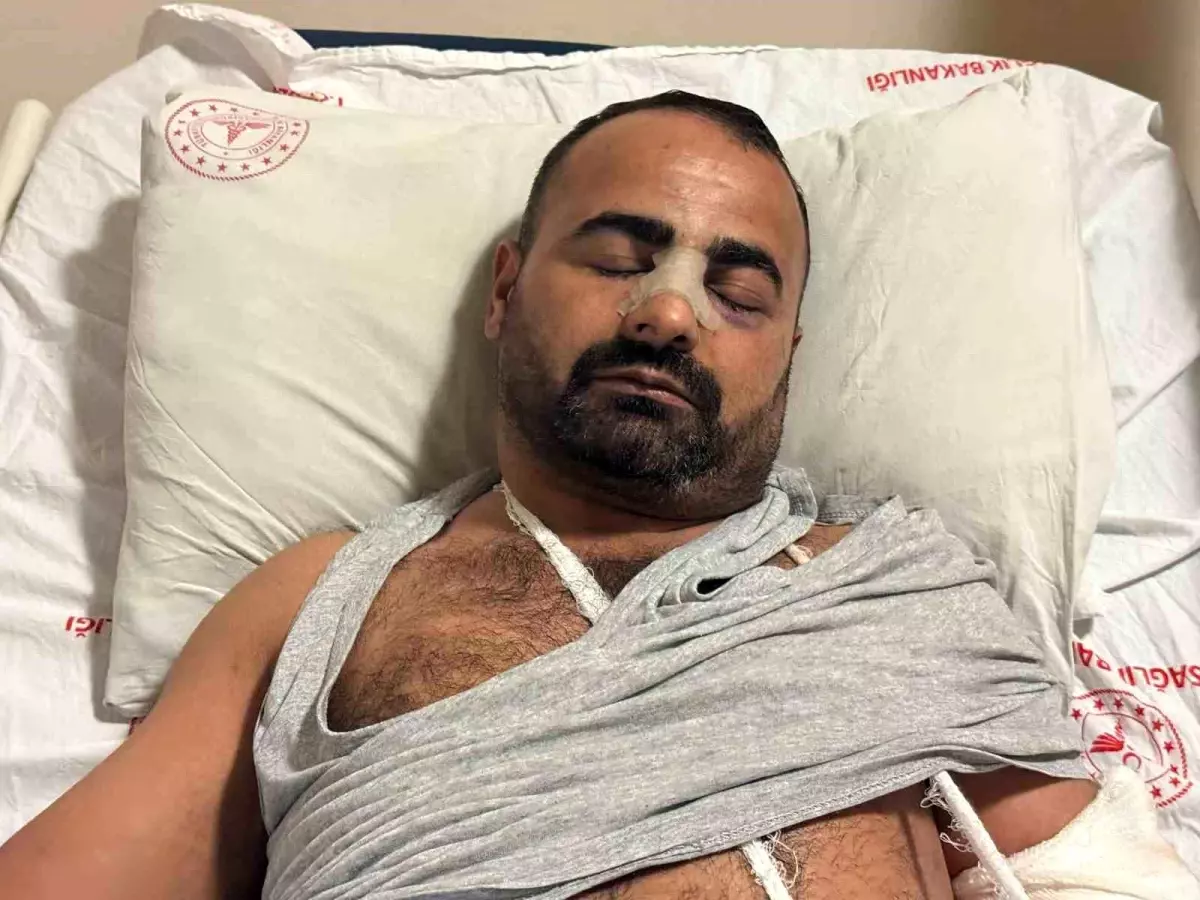 Iğdır'da Darp Olayı: Eski Eşin Kıskançlığına Kurban Gitti