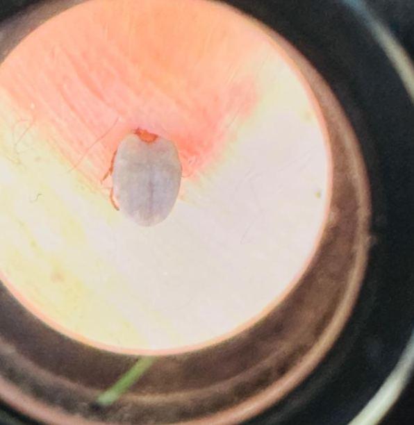 The woman who went to the hospital with complaints of weakness experienced the shock of her life! She couldn't believe what came out of her abdomen