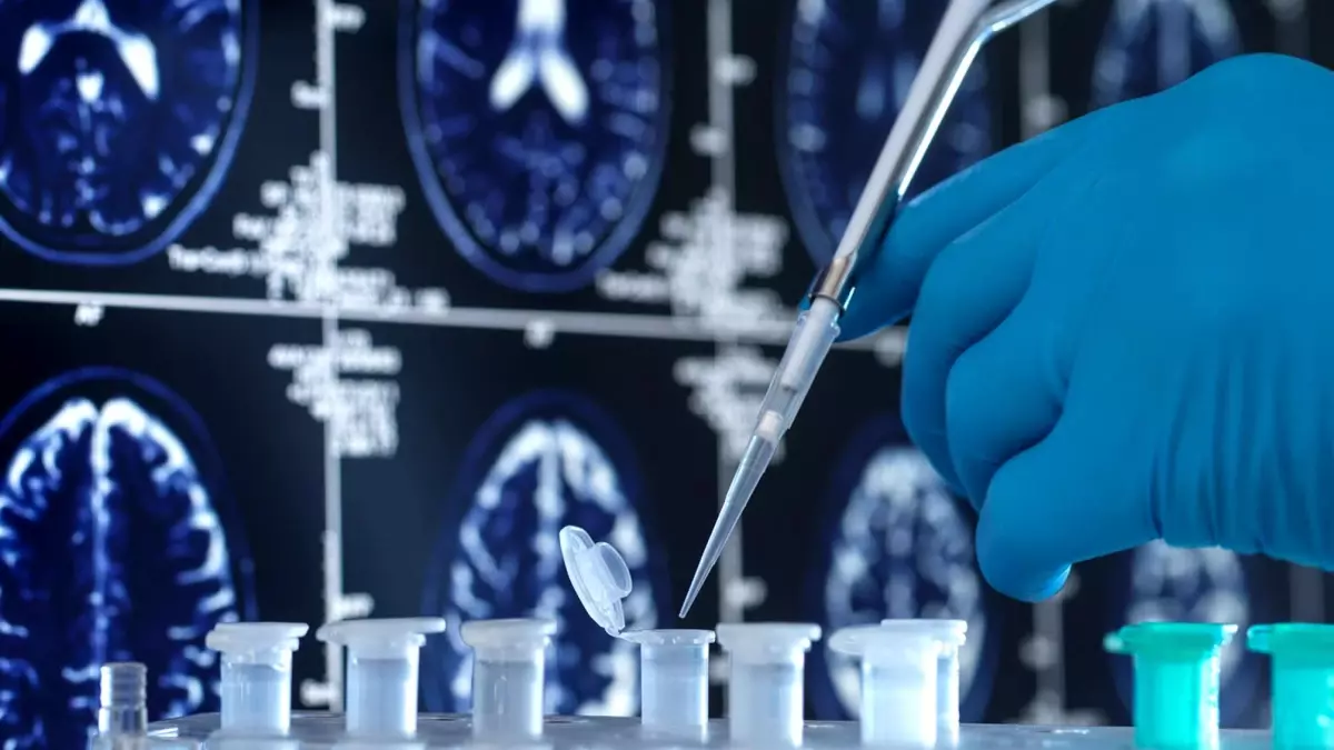 Alzheimer'a virüsler mi yol açıyor?
