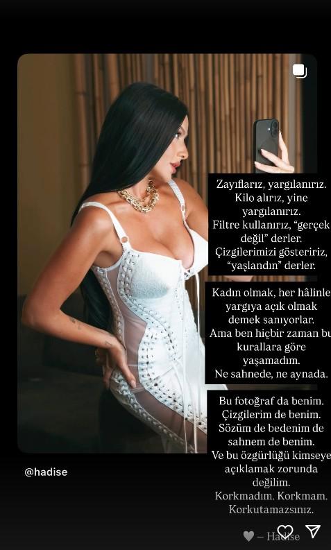 Hadise's striking response to the comments about her wrinkles