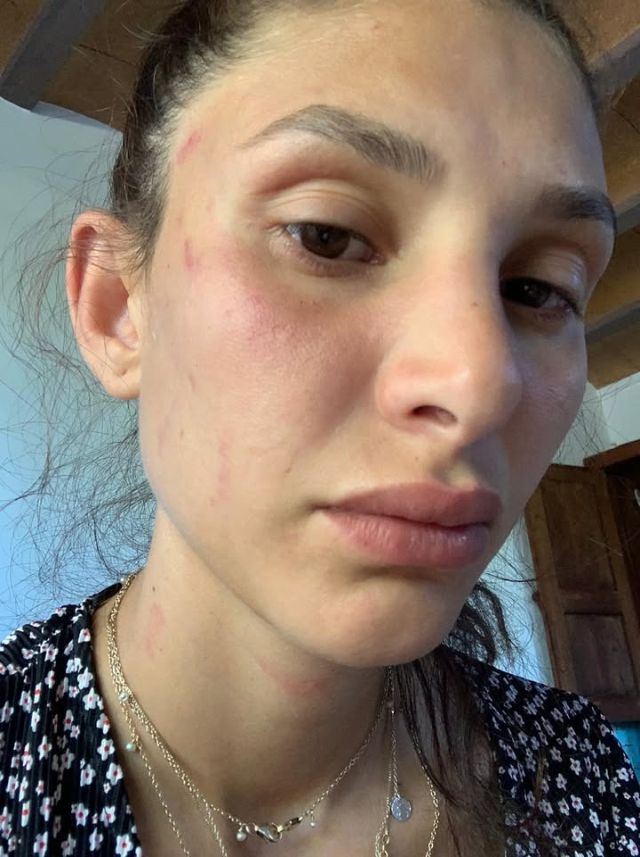 Can Yaman's girlfriend Sara Bluma revealed that she was subjected to violence