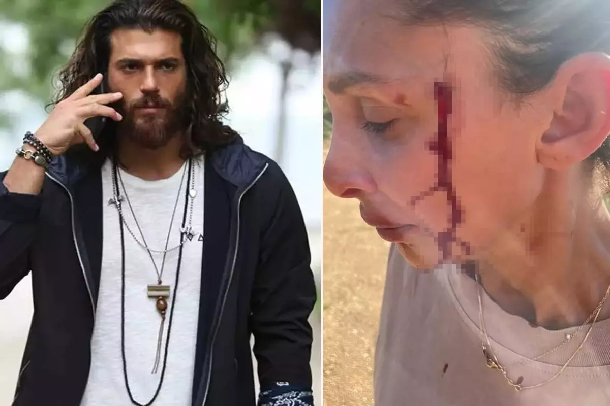 Can Yaman'ın sevgilisi Sara Bluma şiddet gördüğünü açıkladı