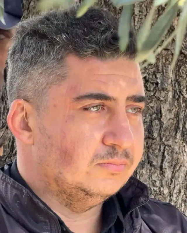 Fire in Aydın and Allegations: Turgay Gezgin's Sister Continues to Raise Suspicions