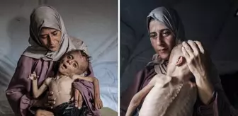 Bez yerine plastik poşet sarılmış açlıktan ölmek üzere olan çocuğun yürek burkan hikayesi