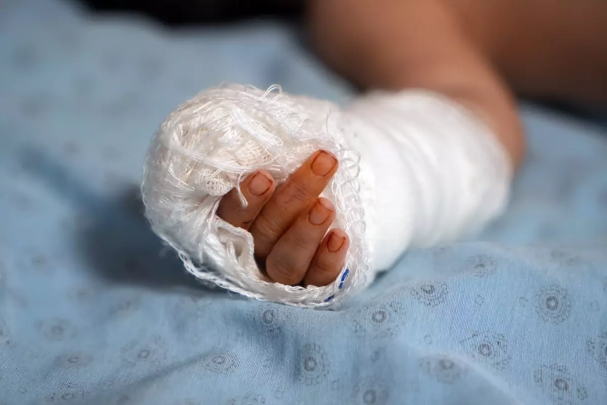 Hemşire, serumu çıkarırken bebeğin parmağını kopardı