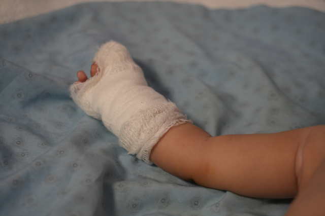 Nurse cut the baby's finger while trying to remove the IV