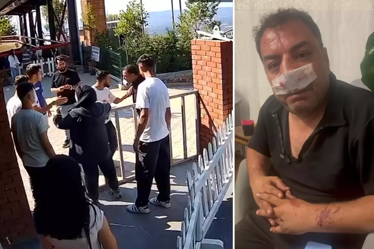 Turistlerden 4 fotoğraf için servet istediler, kavgada araya giren şoförün burnunu kırdılar
