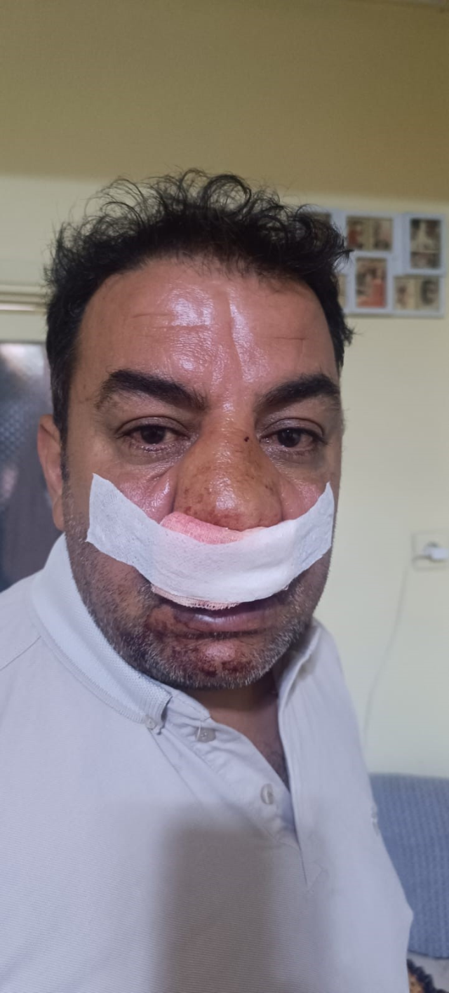 They demanded a fortune for 4 photos taken without permission, the intervening driver had his nose broken