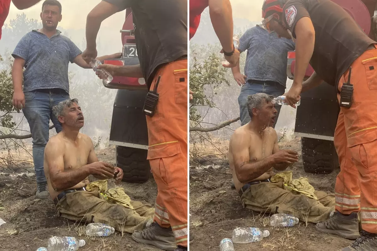 'Yanıyorum!' diyerek feryat eden orman işçisinin son hali