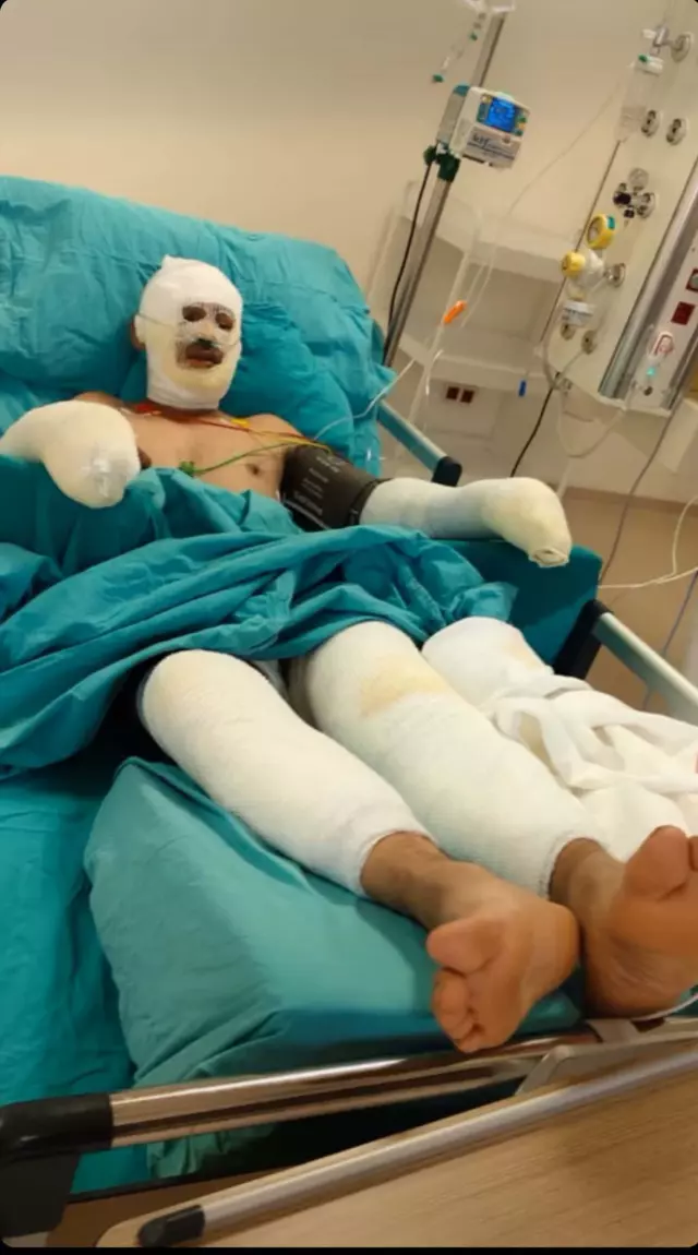 'I'm burning!' cried the forest worker