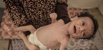 24 saatte 6 kişi daha açlıktan öldü, 7 aylık Salim bebeğin hayatı tehlike altında